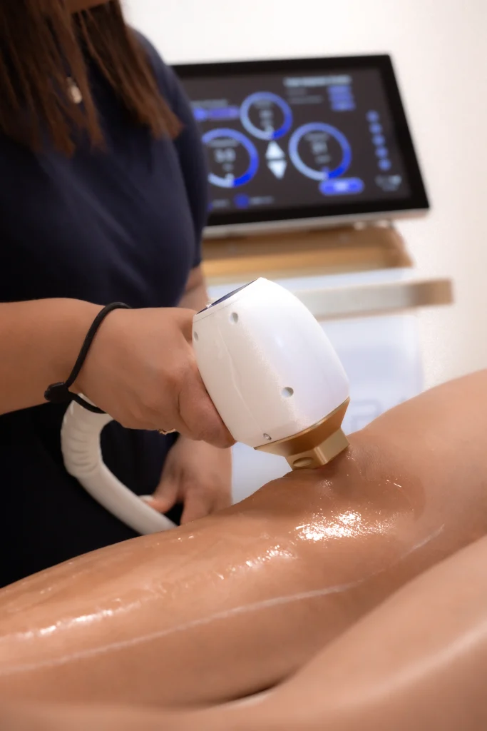 épilation définitive au laser à lamarque pontacq chez l'atelier de fanny